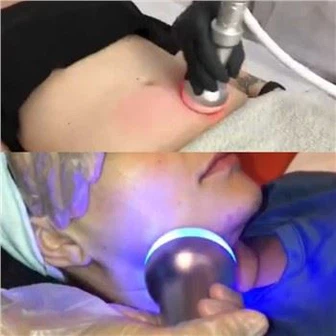 Kryoterapeutický přístroj na hubnutí