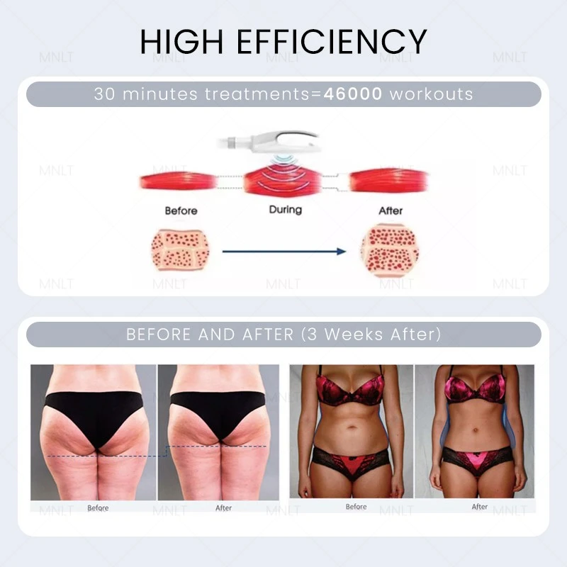 2024 Hot Sale Ems Body Sculpt Machine