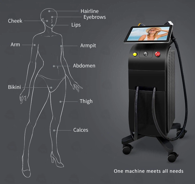 Factory Price Soprono Diode Laser Hair Removal Machine