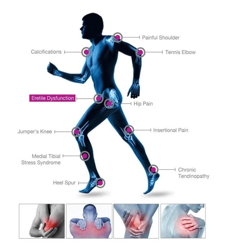 Portable Shockwave Therapy Machine price